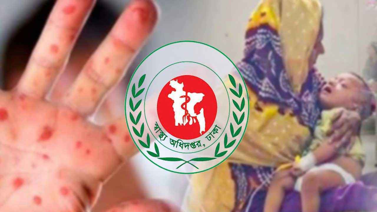২৪ ঘণ্টায় হামের উপসর্গ নিয়ে আরও ২ শিশুর মৃত্যু