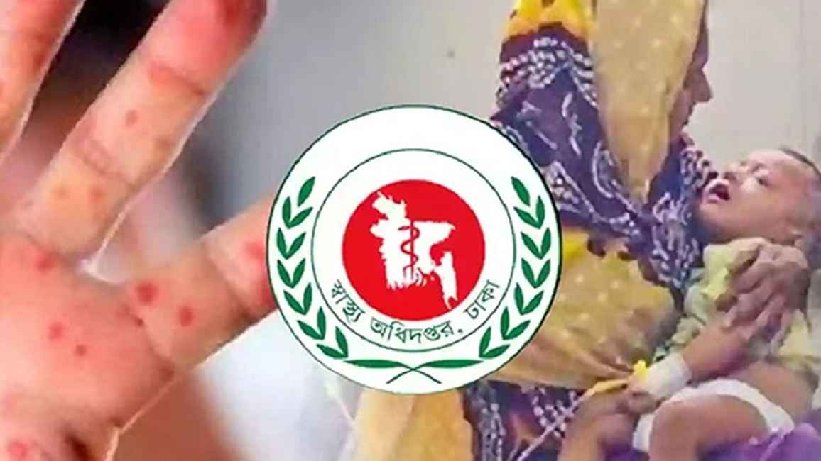 হাম উপসর্গে আরও ৮ মৃত্যু, প্রাণহানি ছাড়াল ৯০০