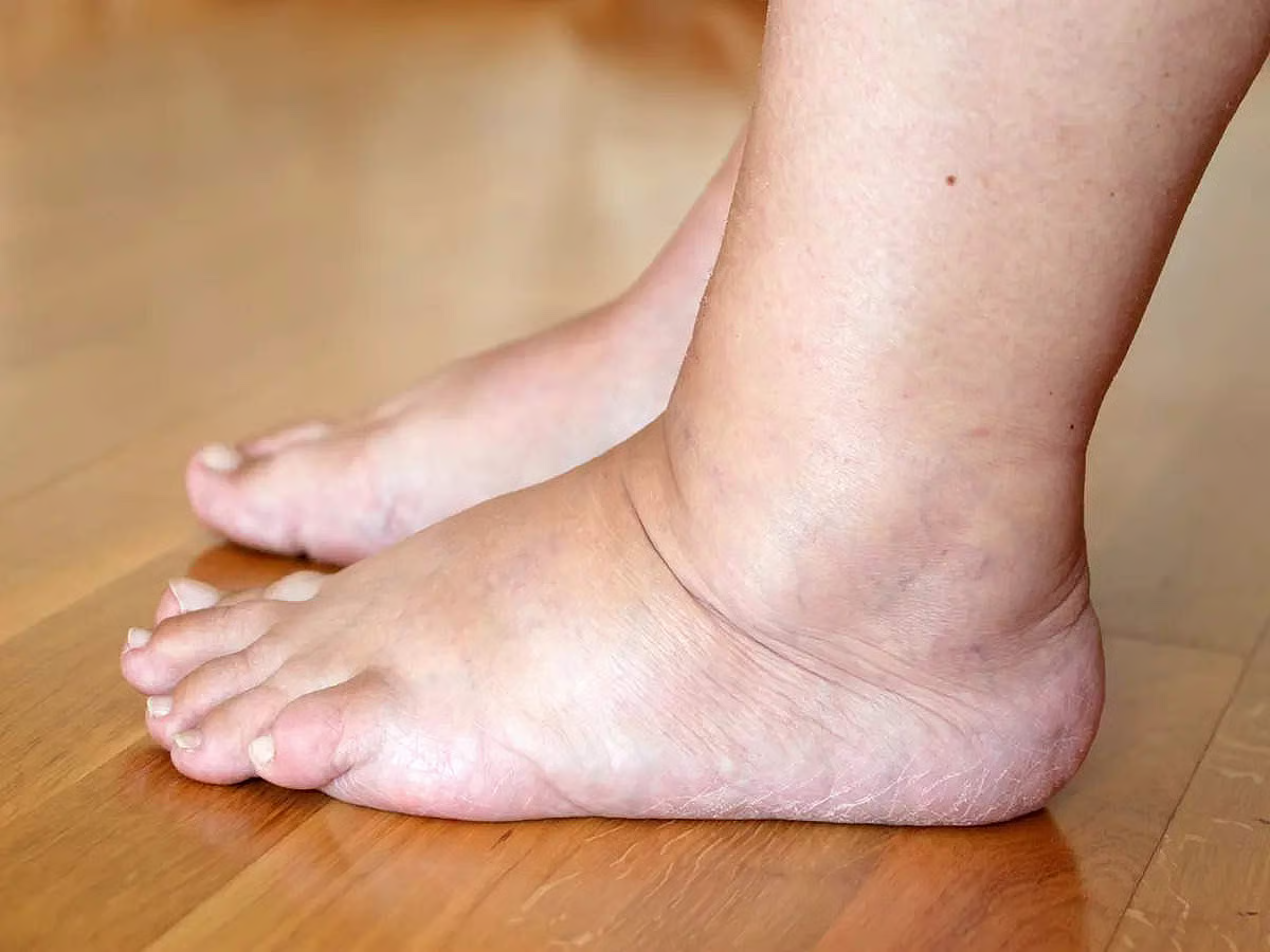 leg
