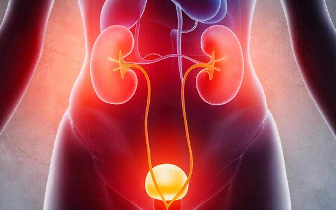 Urinary-Tract-Infection-1080x675