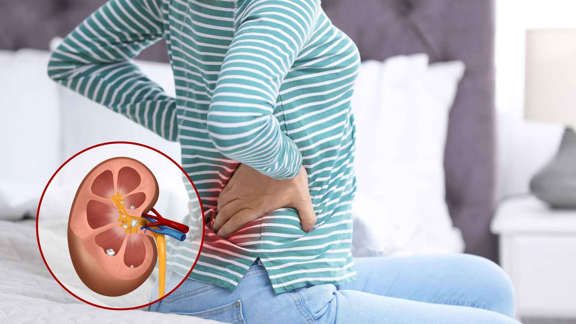 ঋতু বদলের সময় কিডনিতে পাথর হওয়ার ঝুঁকি বাড়ে কেন?