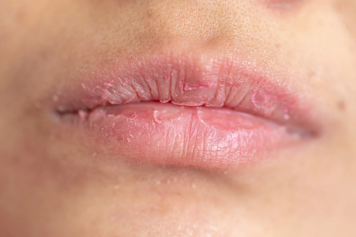 lip_3