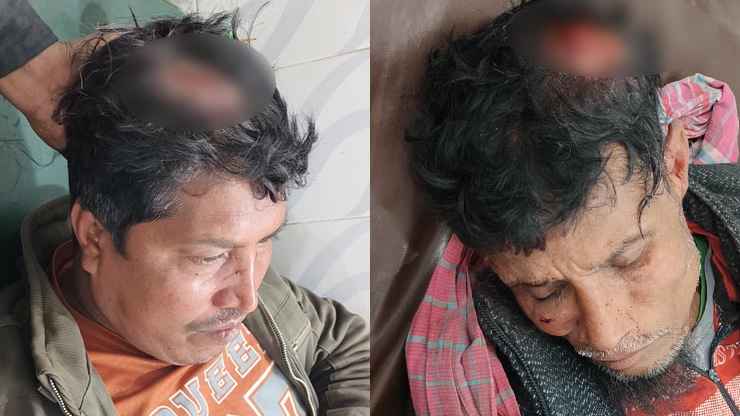 নাটোরে ধানের শীষের কর্মীদের হামলায় মাথা ফাটল দুজনের