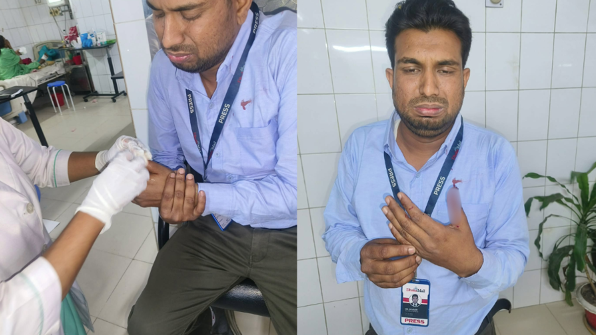 পুলিশি হামলায় ঢাকা মেইলের শামীমসহ একাধিক সাংবাদিক, নিন্দা ও বিচার দাবি