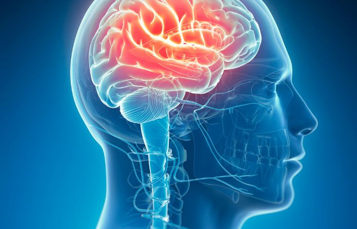 Brain_Stroke