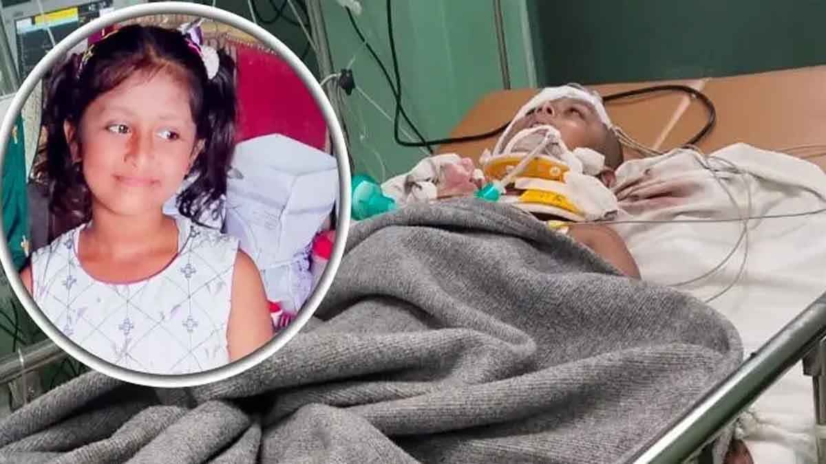 খুলির একটি অংশ খুলে রাখা হয়েছে হুজাইফার, পাঠানো হচ্ছে ঢাকায়