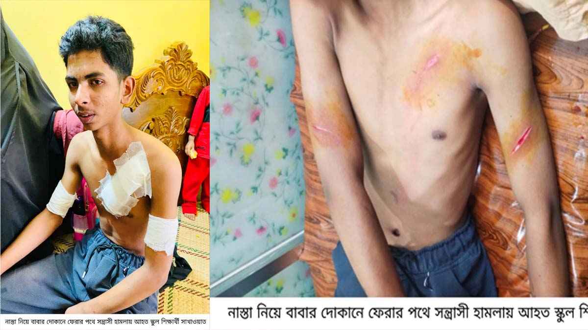 মিরসরাই হোটেল থেকে রুটি আনতে গিয়ে সন্ত্রাসীদের হামলার শিকার শিক্ষার্থী