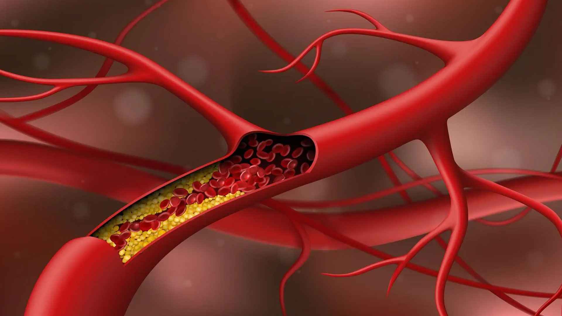 ১ মাসেই কোলেস্টেরলের মাত্রা কমবে মানলে এসব টিপস