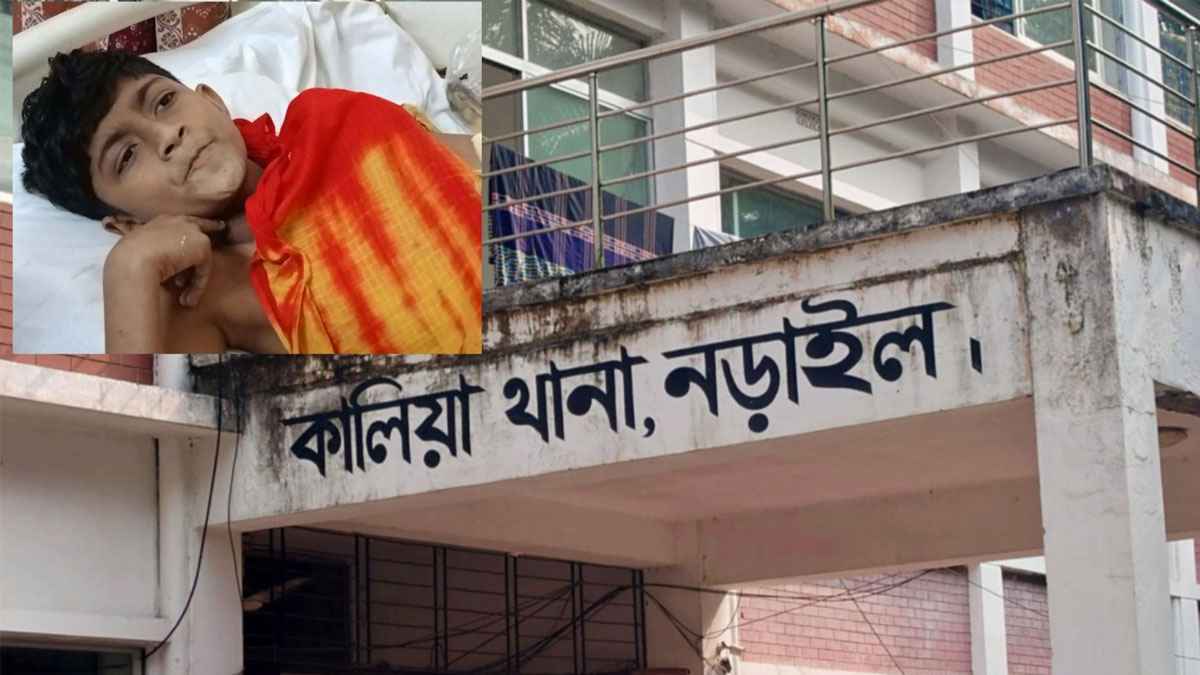 নড়াইলে বোমা সদৃশ বস্তু বিস্ফোরণ, শিশু শিক্ষার্থী আহত