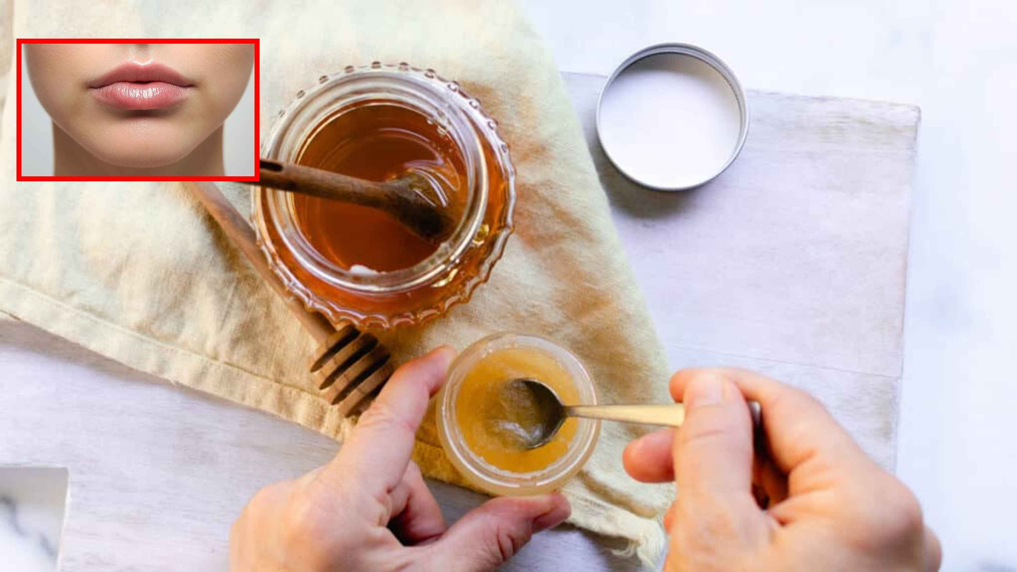 লিপবাম মেখেও ফাটছে ঠোঁট, করণীয় কী?