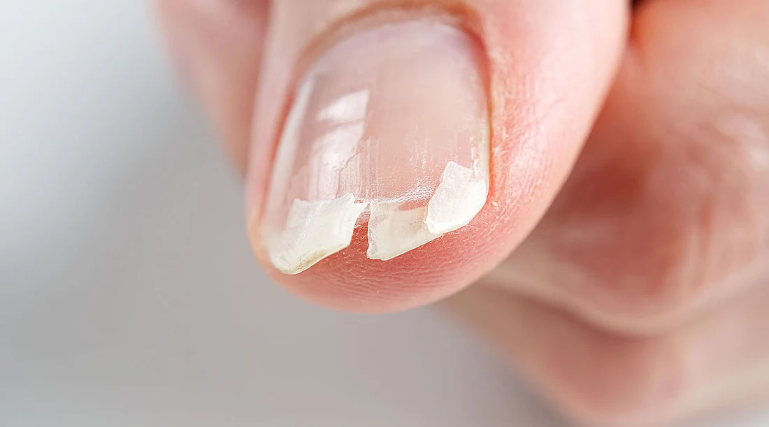nail_1 nail_1
