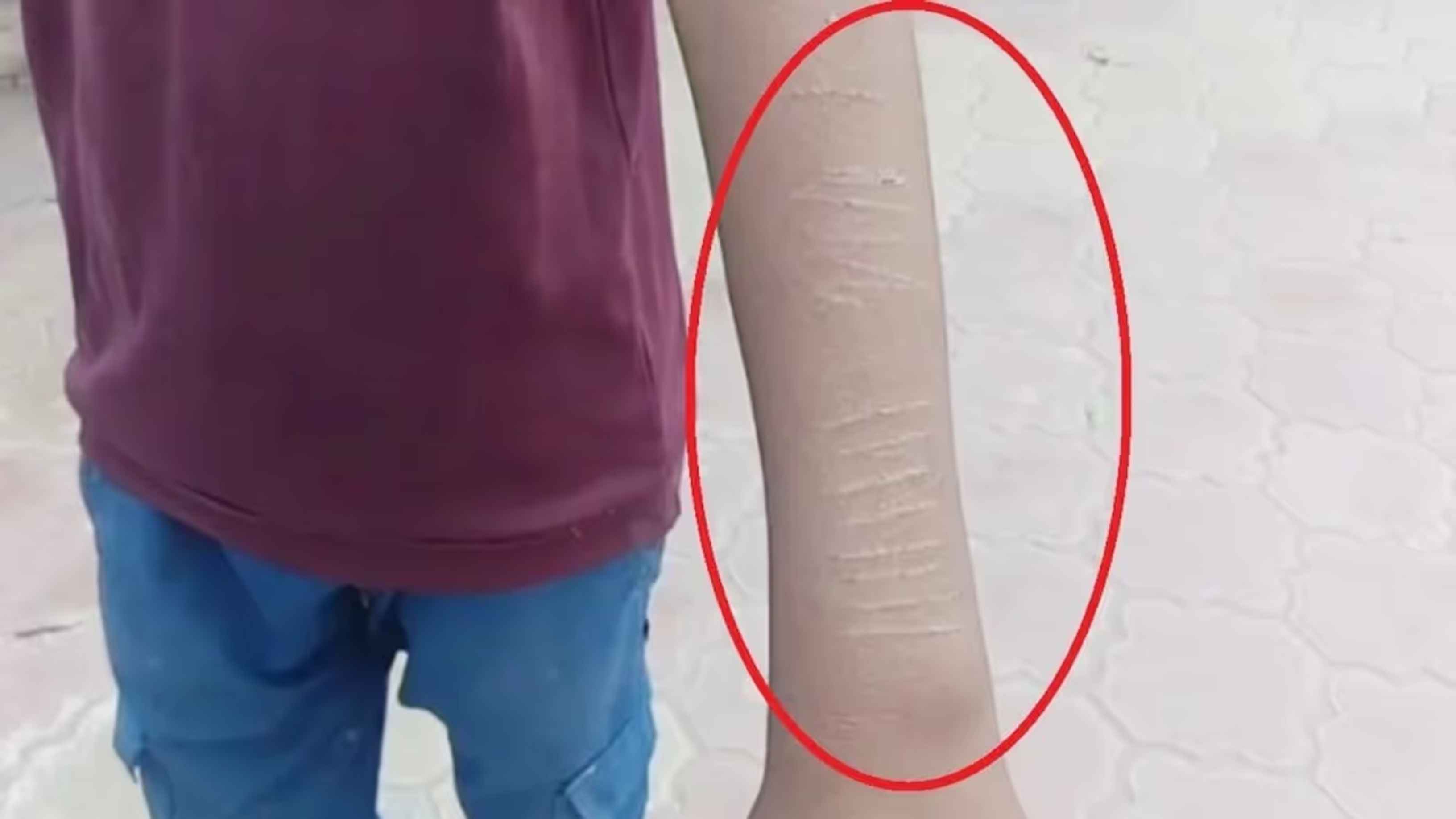 ব্লেডে কাটা দাগ দূর করার উপায় কী?