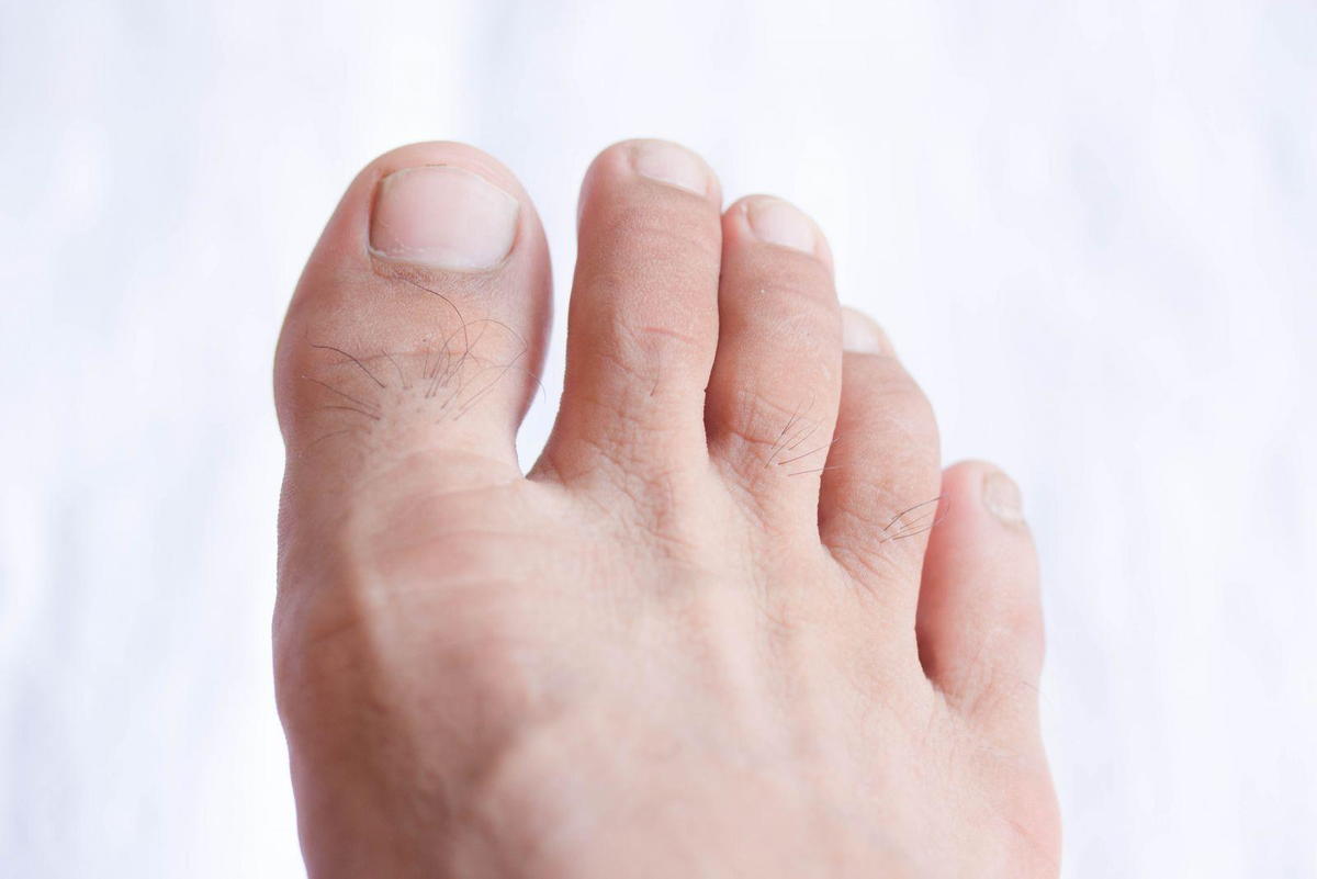 toe_1