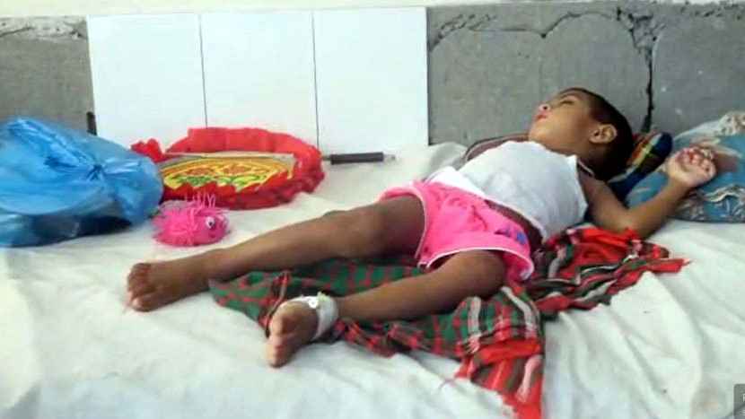 হামের উপসর্গ নিয়ে রংপুর মেডিকেলে আরো এক শিশুর মৃত্যু