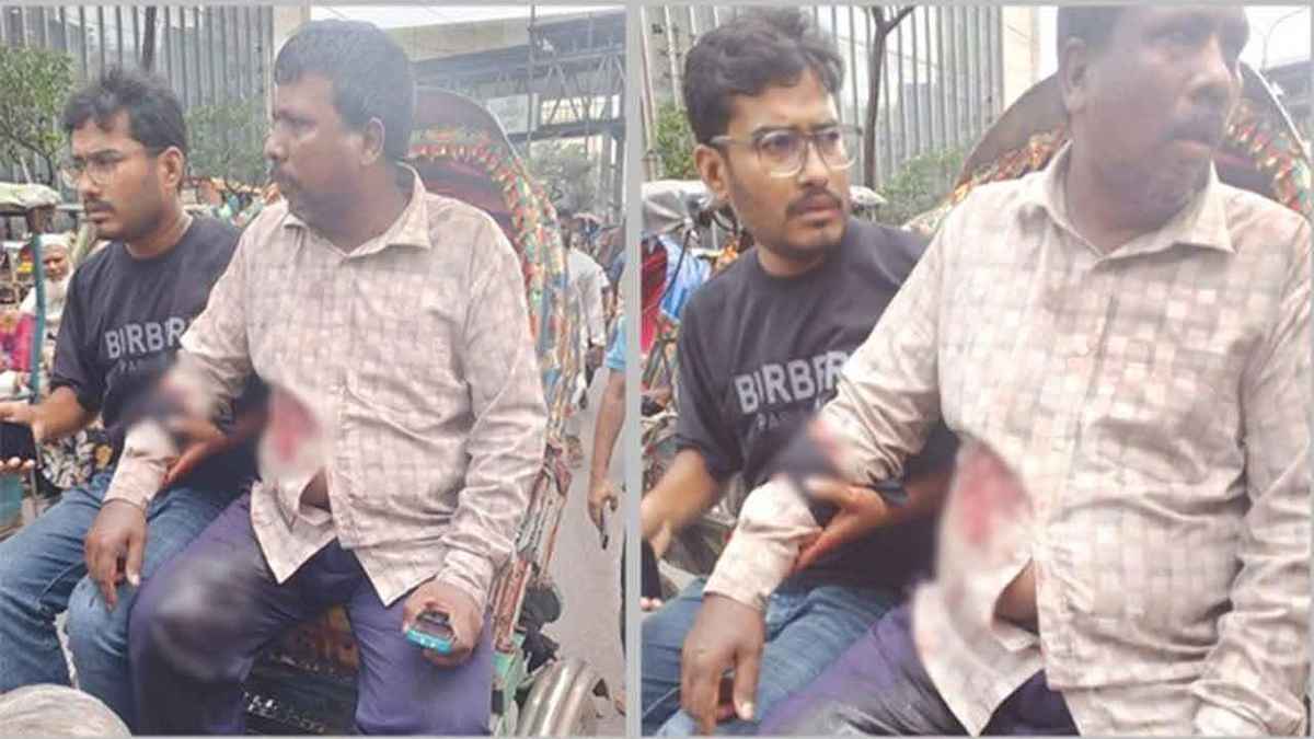 মতিঝিলে ব্যবসায়ীকে গুলি করে ছিনতাইয়ের ঘটনায় এখনো মামলা হয়নি