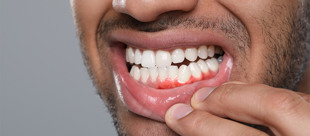 oral