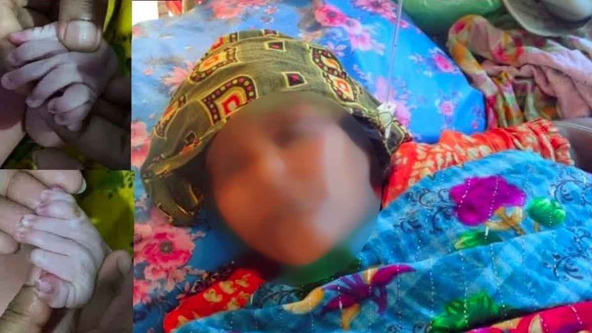 পিরোজপুরে ৩০টি আঙুল নিয়ে জন্ম নেওয়া নবজাতকের মৃত্যু