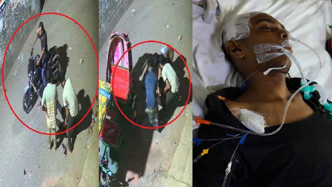 বাইকারকে ইটের আঘাত: টাকার অভাবে চিকিৎসা বন্ধের শঙ্কায় আহত রাফি