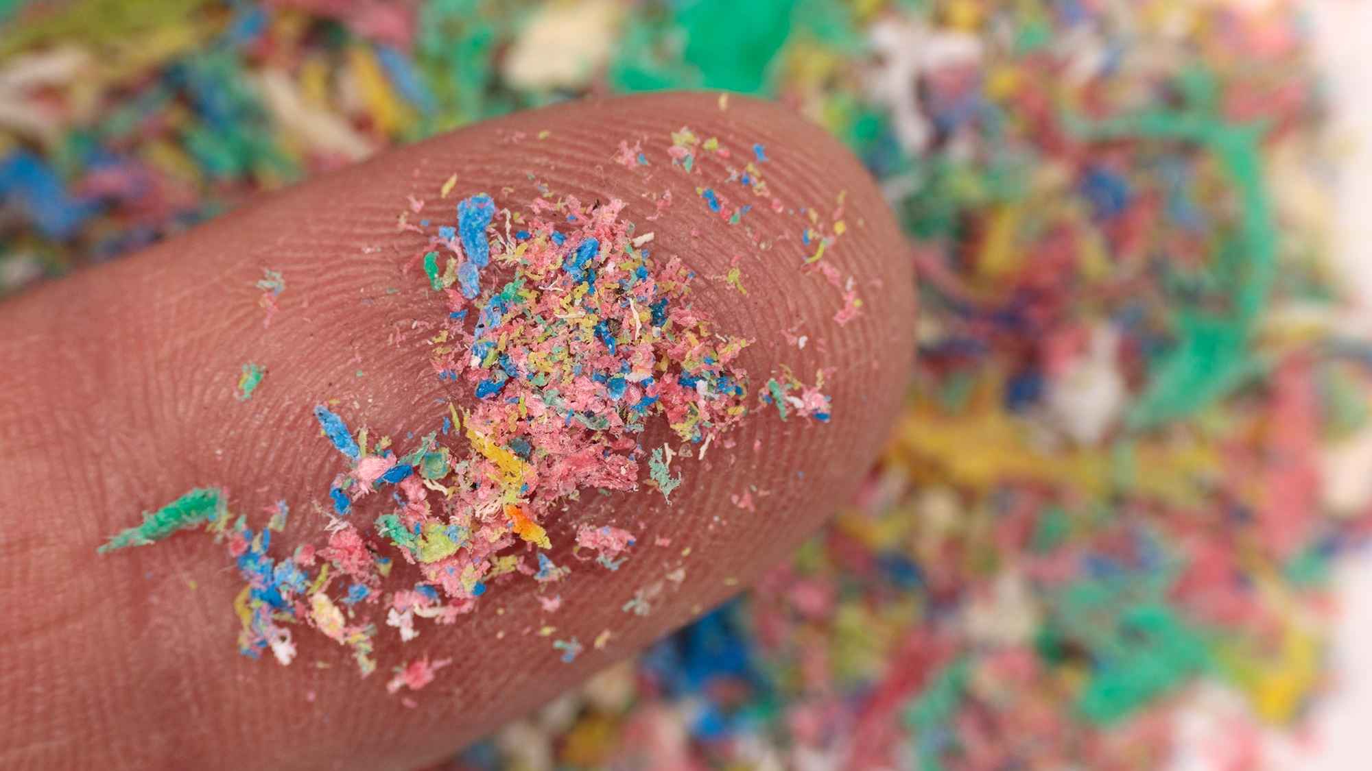 প্রস্টেট ক্যানসারের নেপথ্যে মাইক্রোপ্লাস্টিক! ৯০% রোগীর রক্তে মিলল কণা