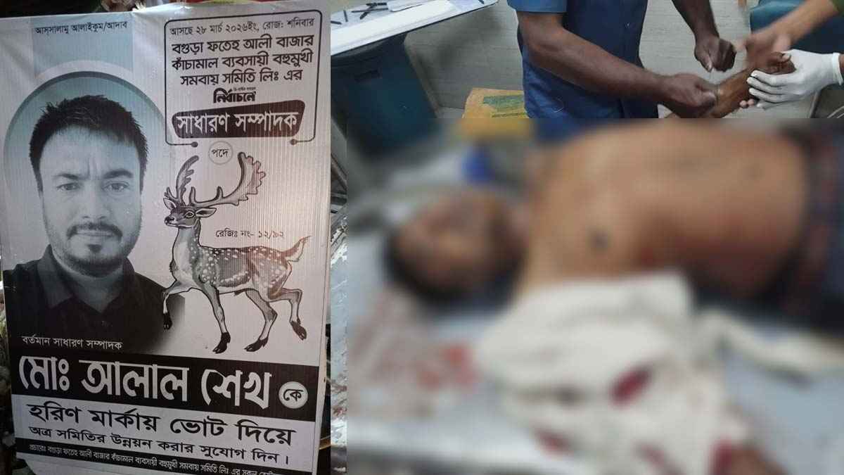 বগুড়ায় বাজার সমিতির সম্পাদক প্রার্থীকে হাত-পা ভেঙে দিয়েছে দুর্বৃত্তরা
