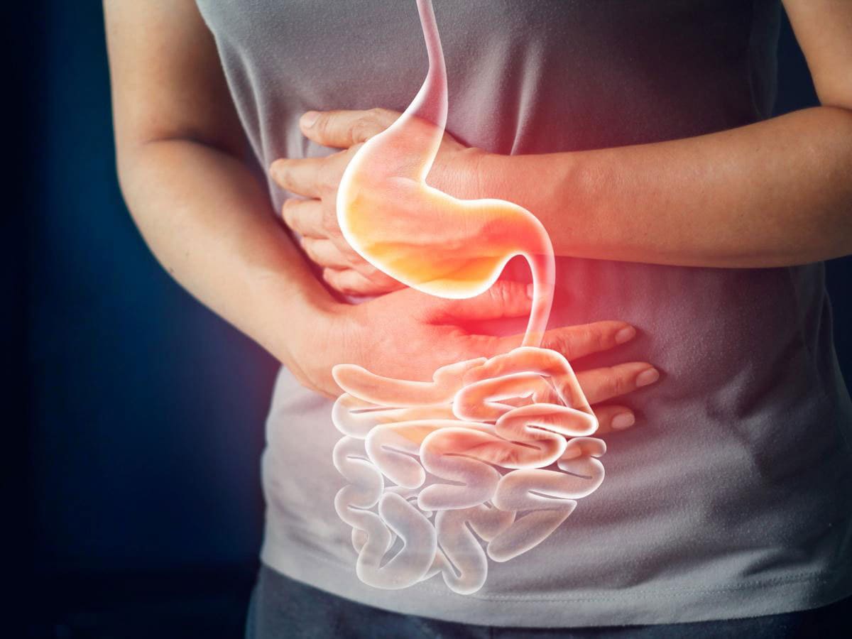 constipation constipation