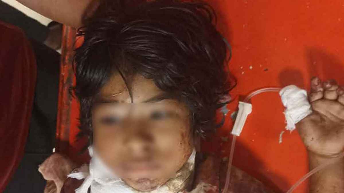 সীতাকুণ্ডের ইকোপার্কে গলা কাটা সেই শিশুটি মারা গেছে