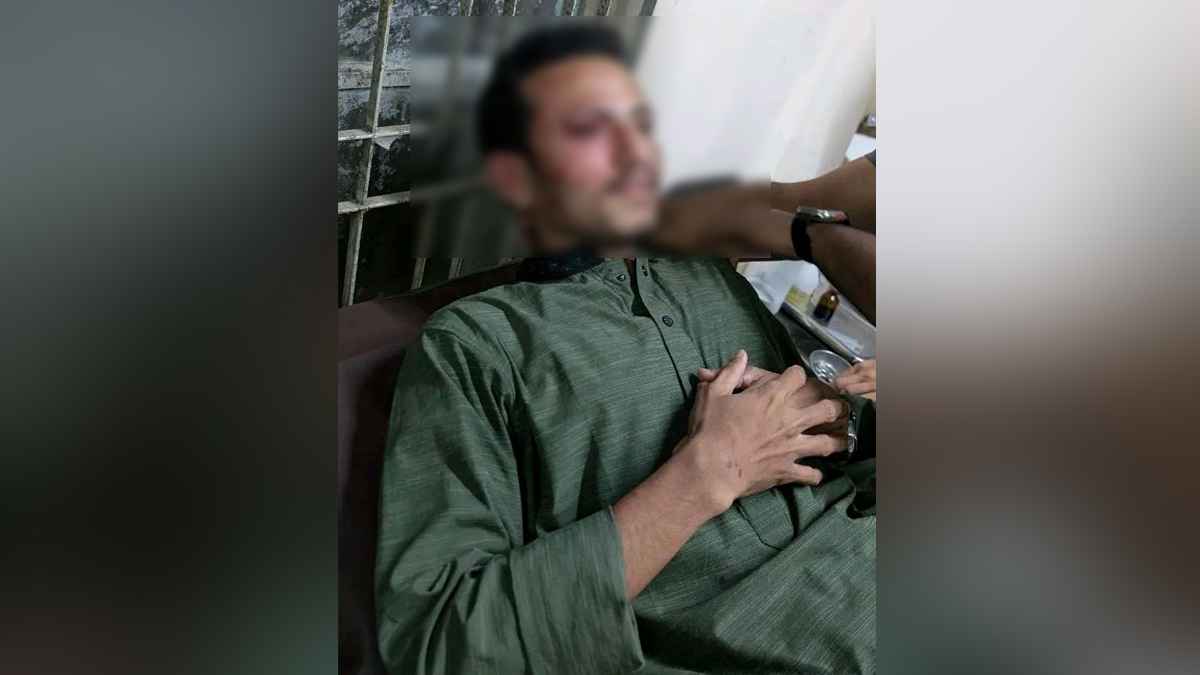 চাকসু পাঠাগার ও ক্যাফেটেরিয়া সম্পাদক মাসুম বিল্লাহর ওপর অতর্কিত হামলা