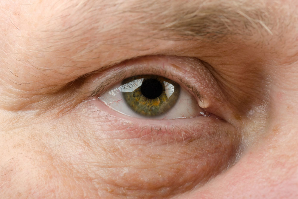 eye
