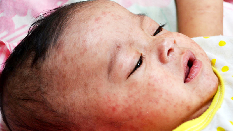 fcbe2c0dcfebae702d4aaadcf3118f36