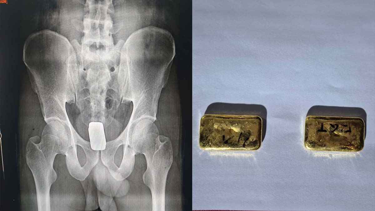 সোনামসজিদ স্থলবন্দরে পায়ুপথে দুই স্বর্ণের বার, আটক ১