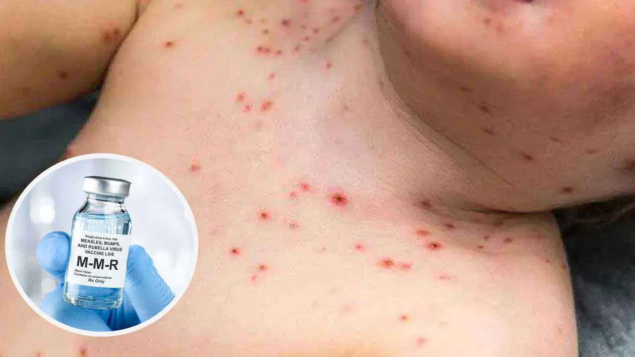 hUM_20260329_180920704