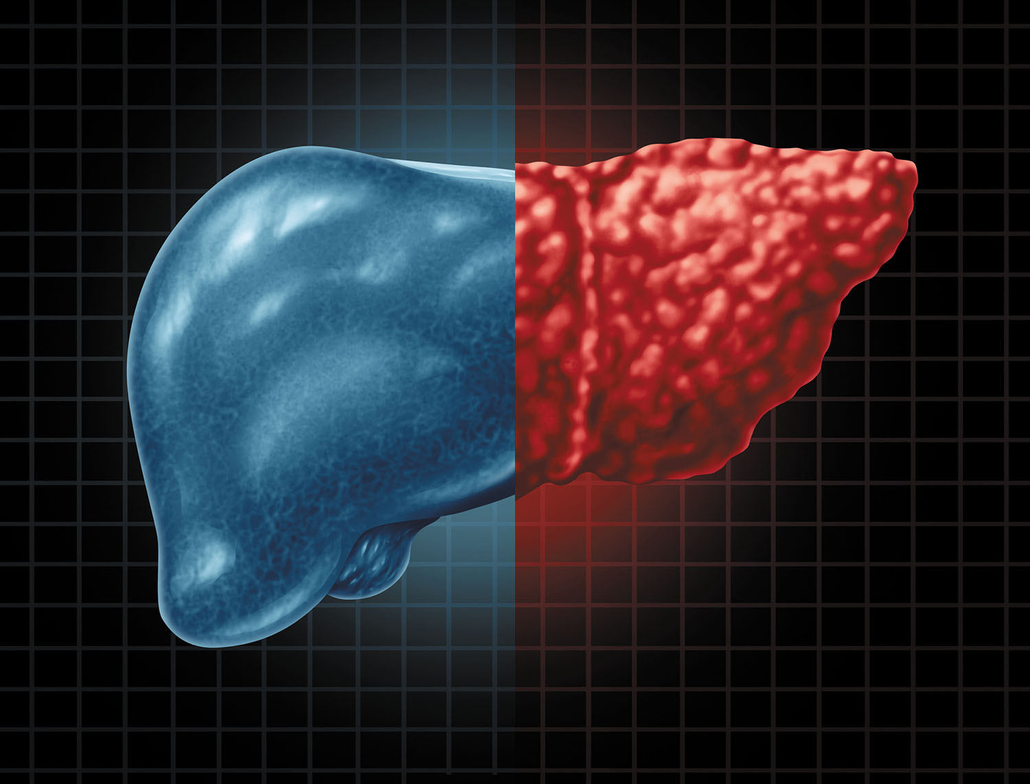 liver_2 liver_2