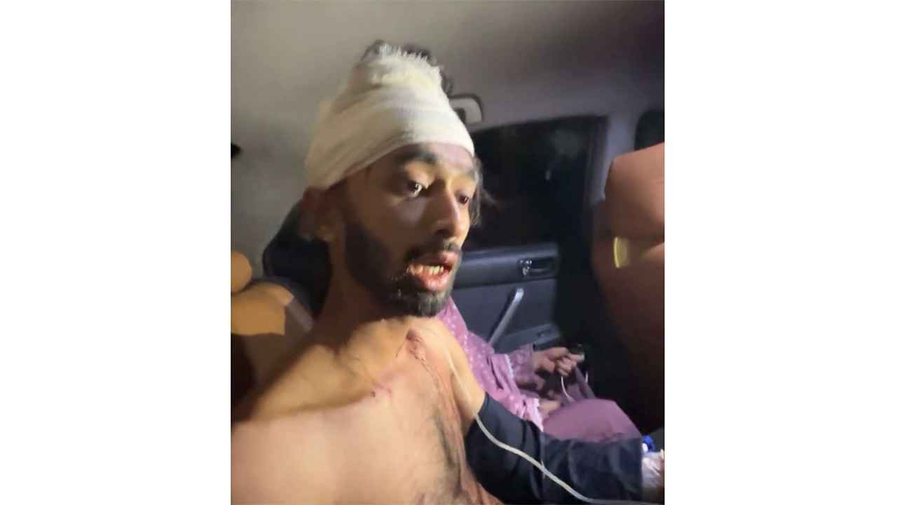 নোয়াখালীতে ছাত্রদল কর্মীকে কোপালো আওয়ামী লীগের নেতাকর্মীরা