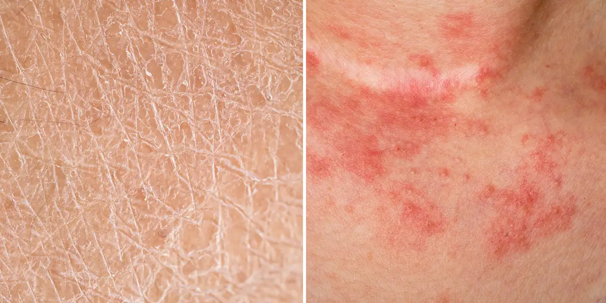 skin