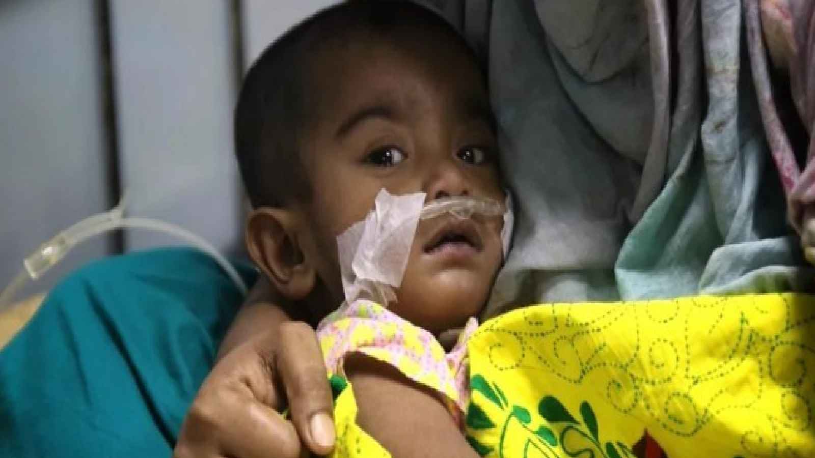 হাম ও উপসর্গে আরও ১২ শিশুর মৃত্যু