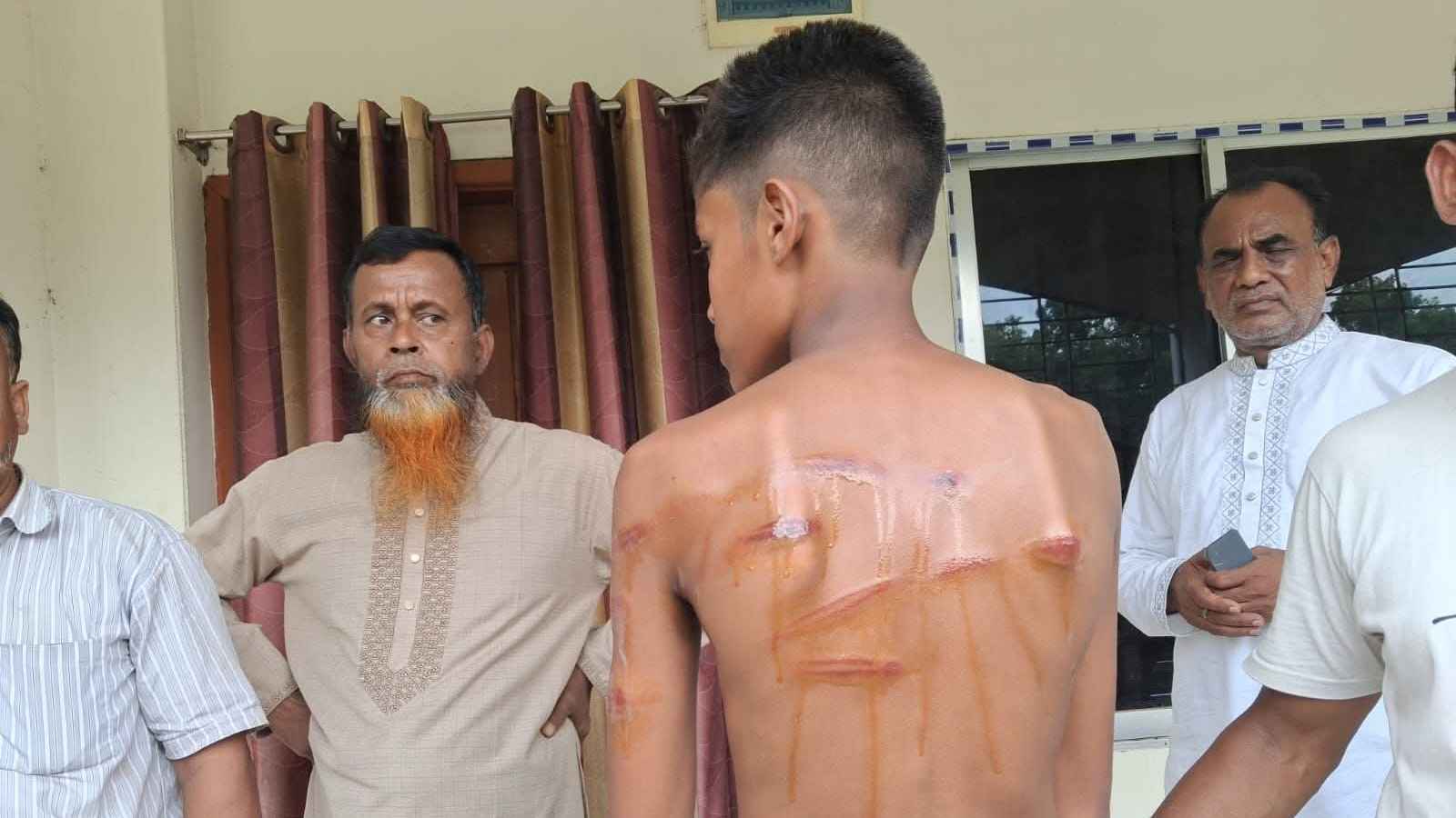 পড়া না পারায় শিক্ষার্থীকে বেধড়ক পিটুনি ও লাথি, অভিযুক্ত শিক্ষক অবরুদ্ধ