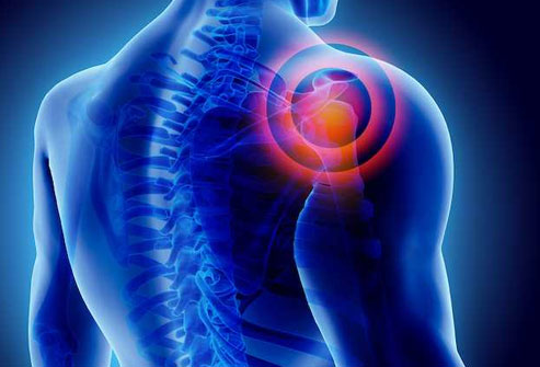 frozen_shoulder