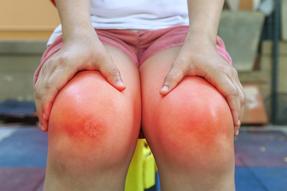 rheumatoid_arthritis rheumatoid_arthritis