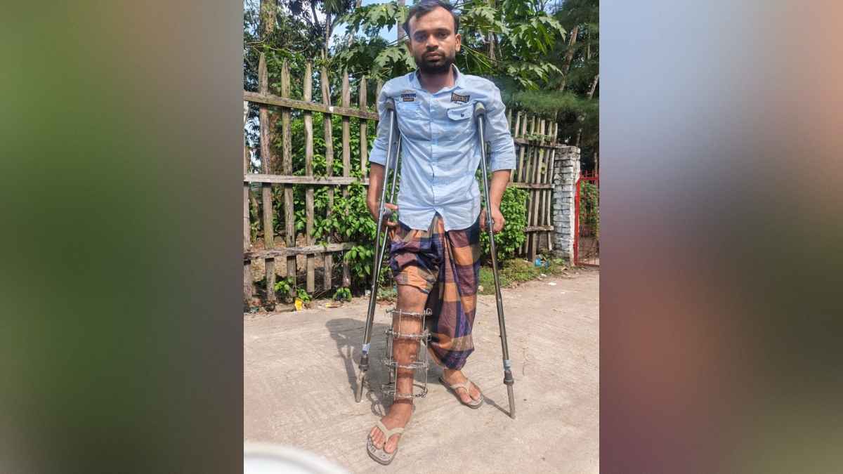 প্রবাসফেরত রায়হানের পা বাঁচাতে প্রয়োজন দেড় লাখ টাকা