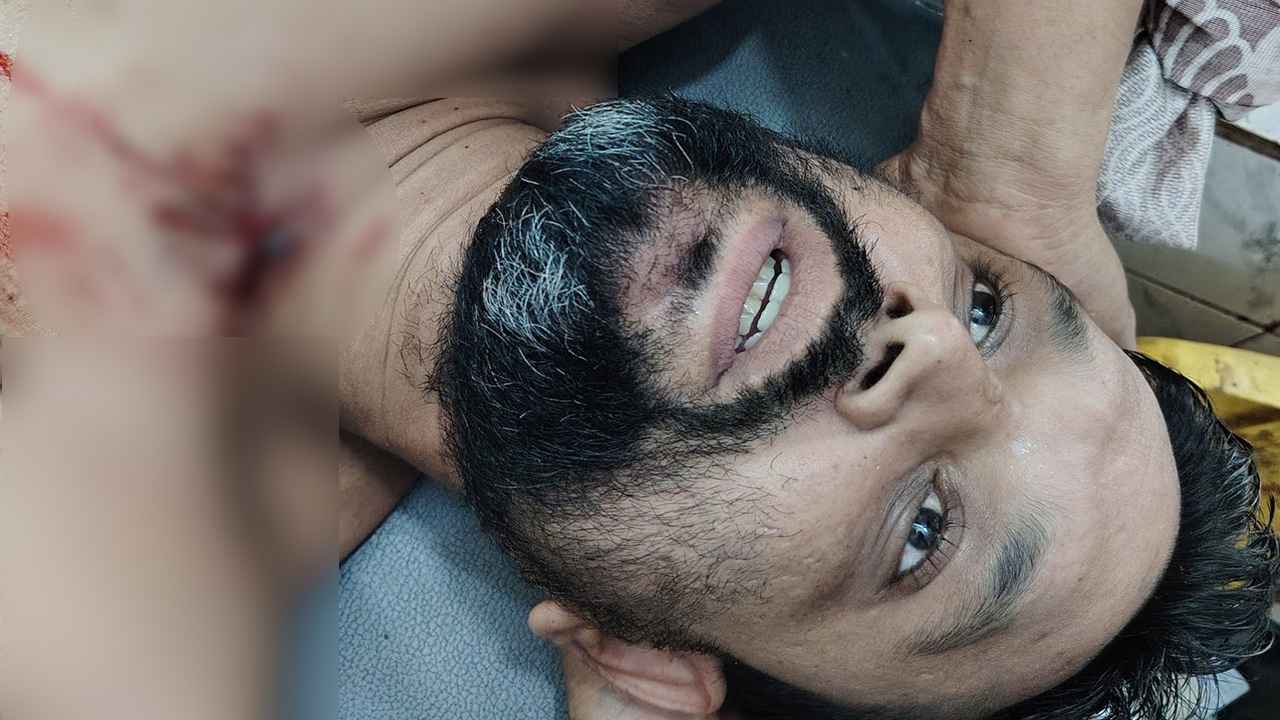 মুন্সীগঞ্জে স্বেচ্ছাসেবক দল নেতার উপর হামলা, ছিনতাইয়ের অভিযোগ