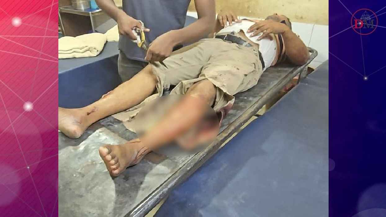 শিক্ষক দিবসে কলেজ শিক্ষককে হাতুড়িপেটা যুবদলকর্মীর