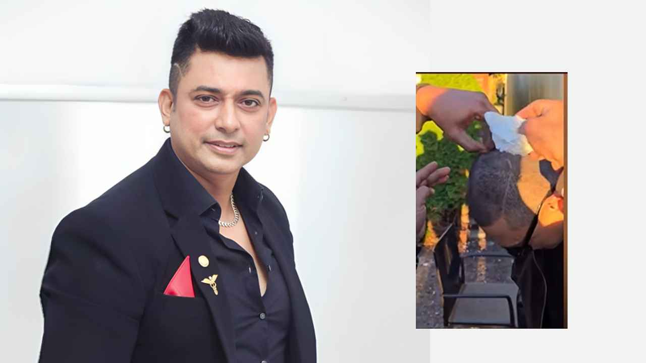 শুটিং সেটে আহত জায়েদ খান