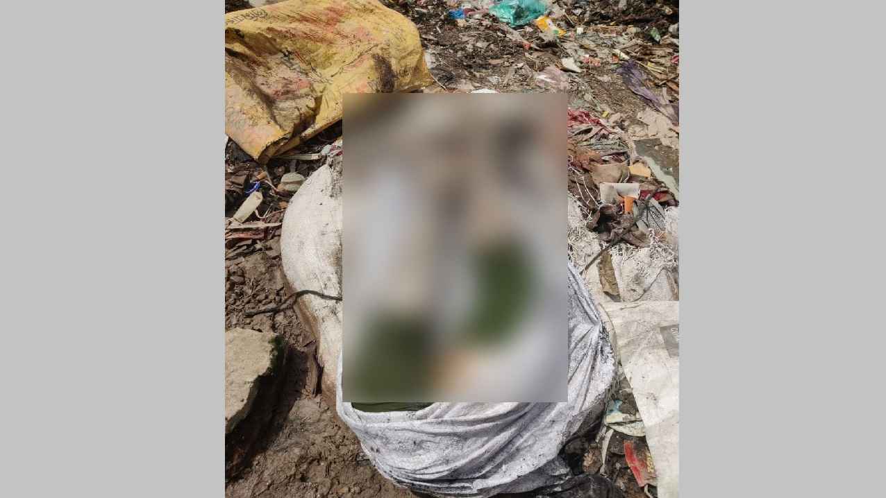 আদাবরে খণ্ডিত সেই নারীর দুই পা উদ্ধার