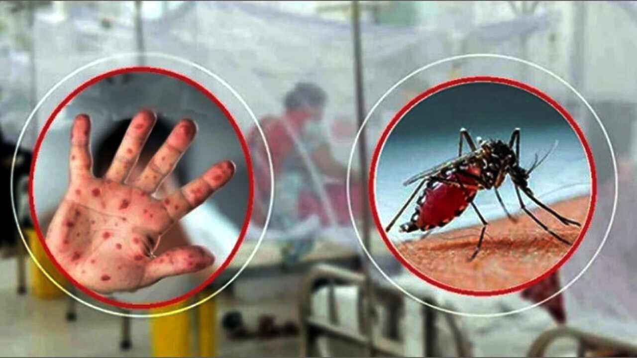 ফেনীতে ডেঙ্গুর সঙ্গে বাড়ছে হাম, আক্রান্ত ছাড়াল দেড় হাজার