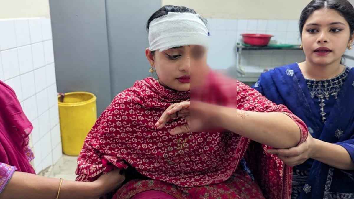 ইভটিজিংয়ের প্রতিবাদ করায় তরুণীর ওপরে হামলা
